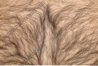 human skin hairy 0011